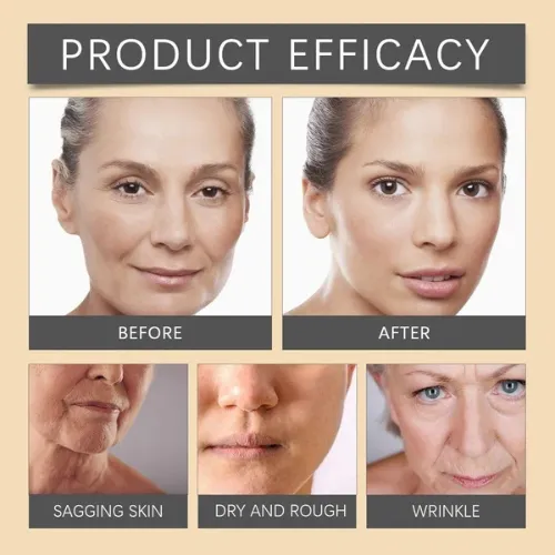 bee-venom-botox-face-cream_1205_aptn.webp