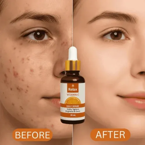 relax-vitamin-c-daily-face-serum-br_1205_6kj4.webp